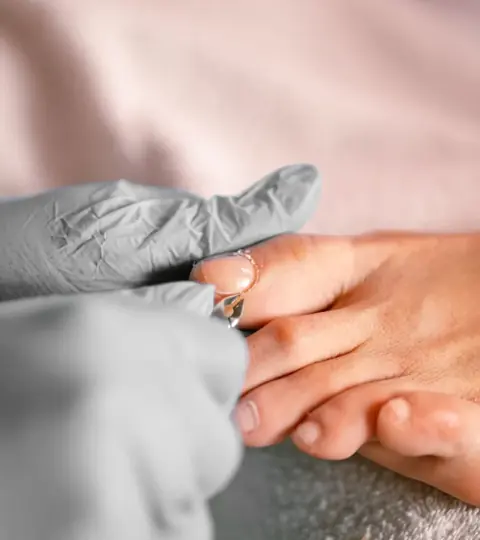 Toenail care details — reference photograph